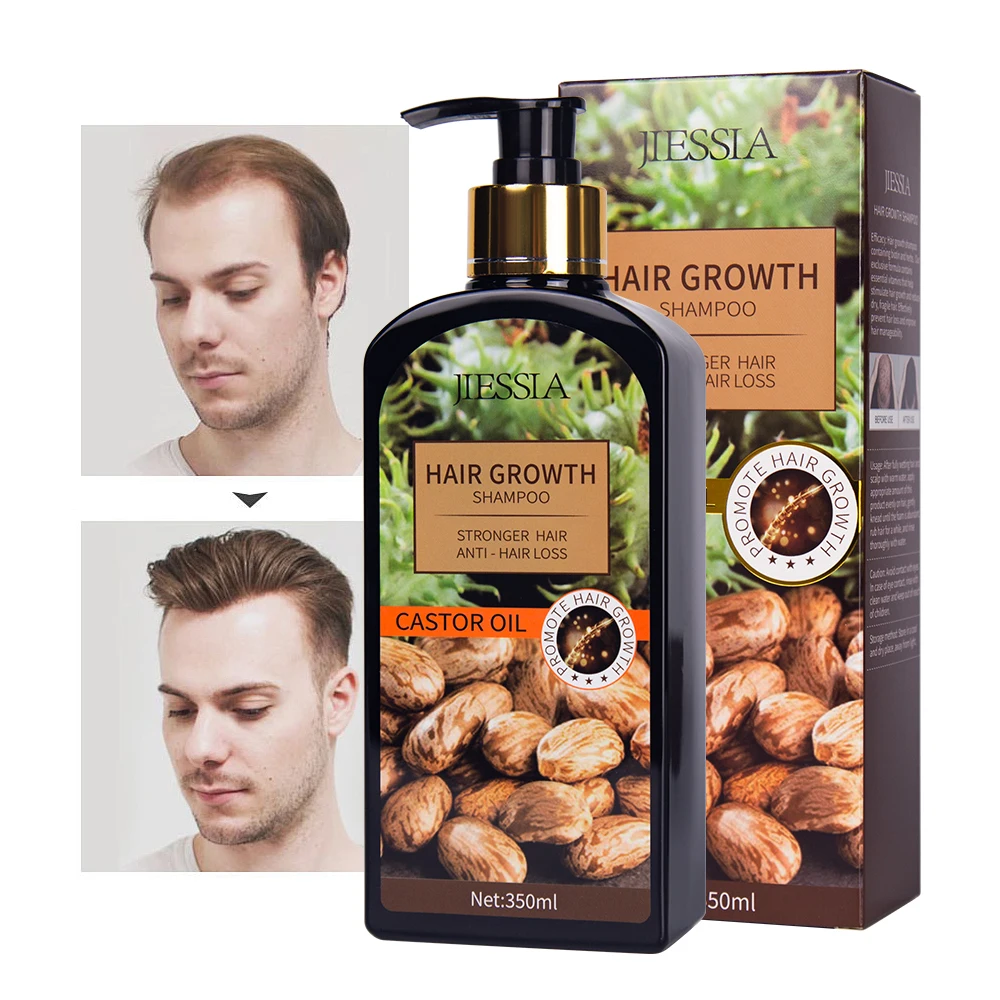 Organic Anti-hair Loss Ginger Conditioner castor oil Mint Oil For Men Women Hair Growth Shampoo