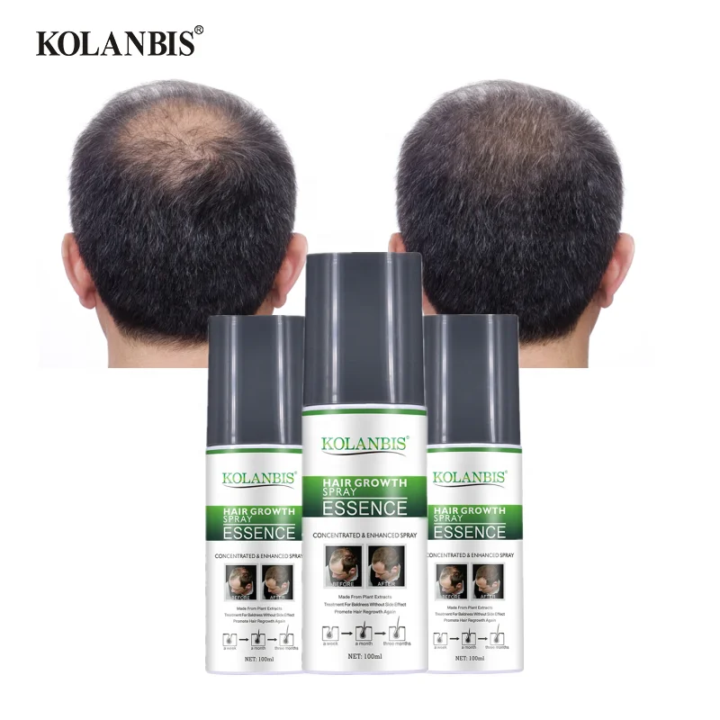 Травяной Растительный Экстракт KOLANBIS, сыворотка для роста волос для женщин и мужчин, ODM OEM