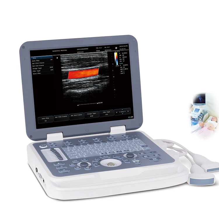 Portable 3d/4d Color Doppler Ultrasound Echo Machine, Diagnostic Ultrasound System for Clinic Abdomen