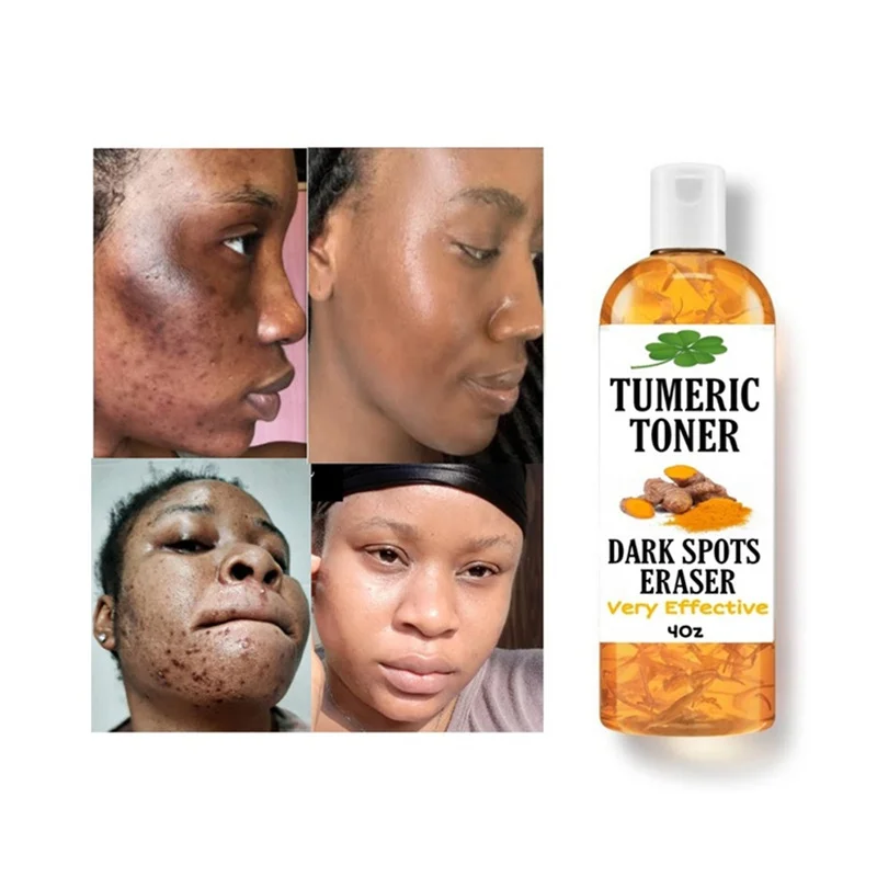 Private Label Hot Sale Facial Strong Lightening Turmeric Toner For Dark Spots Eraser Even Skin Tone Flawless Skin
