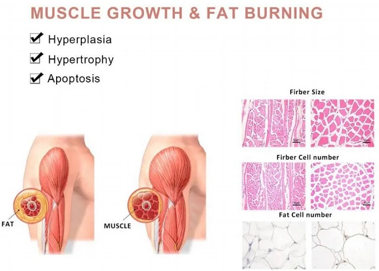  2021 новая технология emslim teslasculpting мышечный Стимулятор ems body sculpting