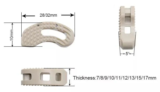 Alif Peek Cage Spine Fixation Orthopedic Implant for Anterior Thoracic Lumbar Spine Surgery Thoracic Lumbar Spinal Implants