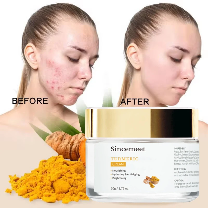 100% Organic Turmeric Intense Night Cream With Hyalurnoic Acid Brightening And Hydrating Facial Skin Renewing Face Cream