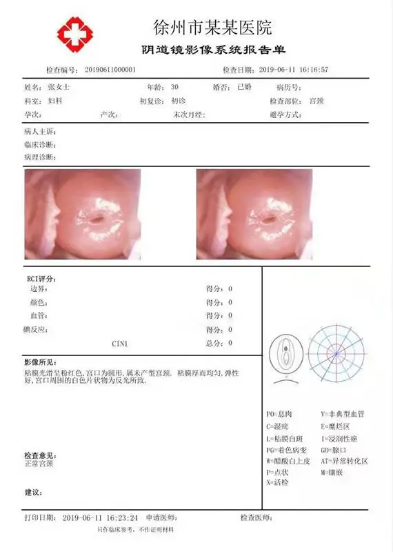 
Passed colposcopy machine digital video colposcope for gynecology examination 