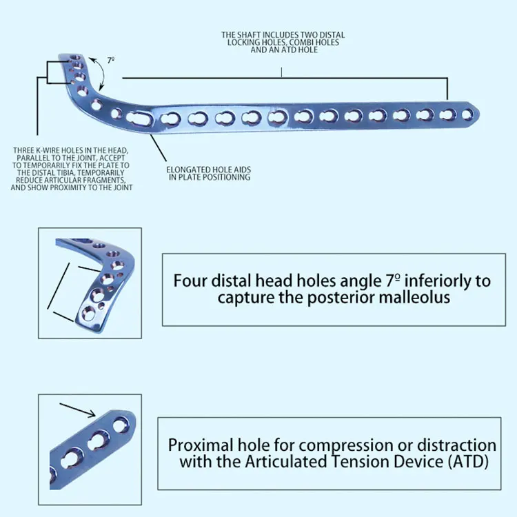 Orthopedic Clavicle Trauma Implants LCP Titanium Plate and Screw Distal Clavicle Locking Plate