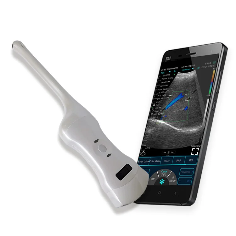 Konted wireless ultrasound C10QT  pregnancy hysteroscopy gynecology urology ureteroscope colposcope for gynecology convex