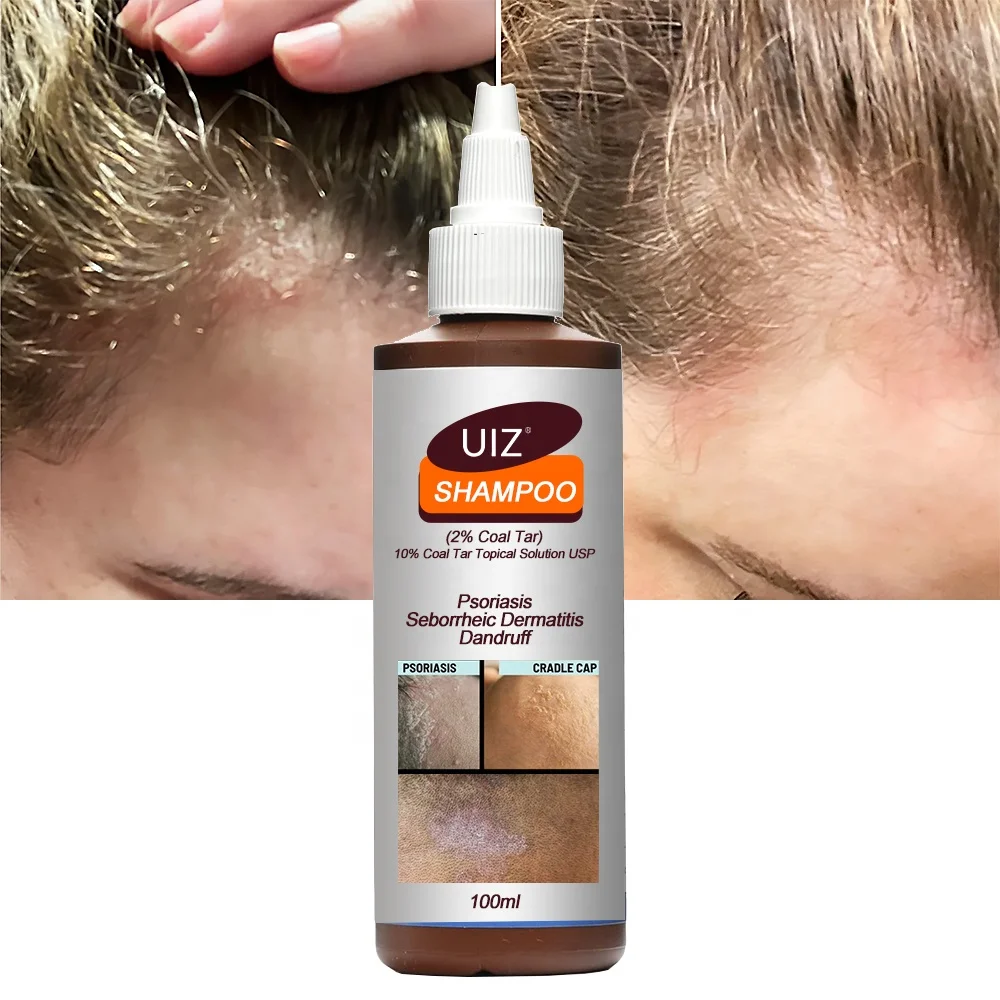 Psoriasis hair Shampoo 2% Coal Tar Extract Seborrheic Dermatitis Dandruff Itchy Scalp Folliculitis Treatment Shampoo