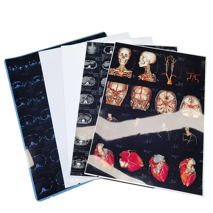 Medical Dry Film X-ray Film 210 Microns Inkjet Film Blue