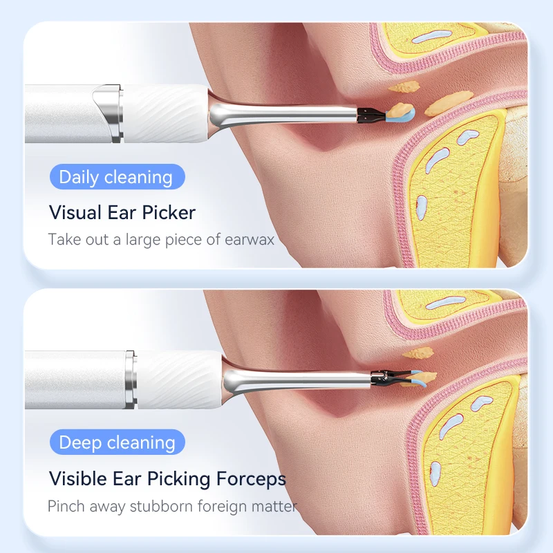 SUNUO New Arrive S3 Pro Tweezers 4 in visual ear camera wifi HD 1080p ear scope endoscope ear wax cleaner remover Videoscope