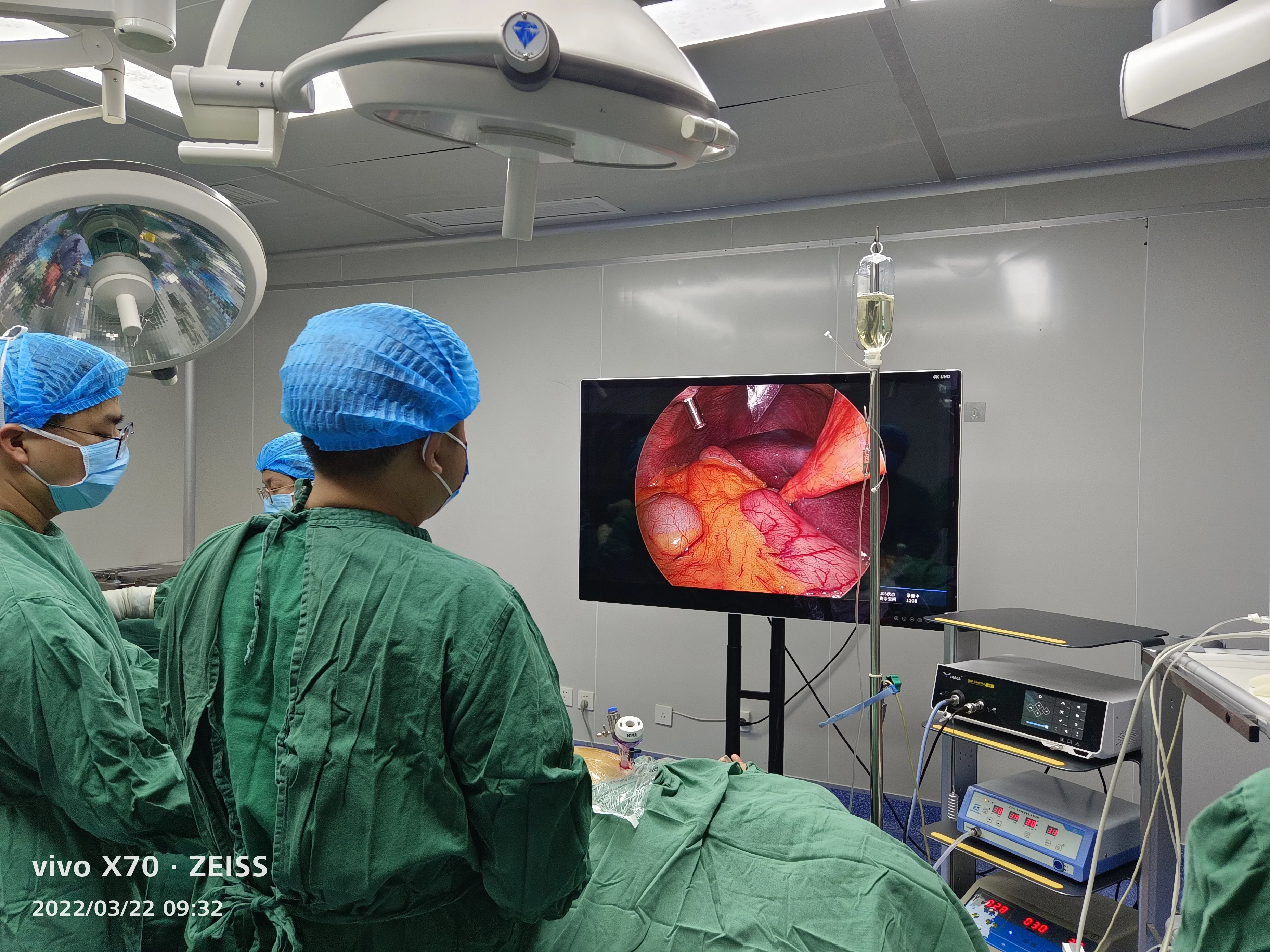 YKD-9210 Full HD 4K Integrated Medical Endoscope Camera For Urology Surgery