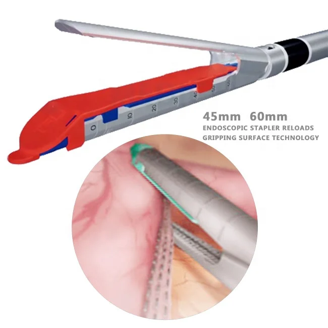 Эшелонная нагрузка серии ECR60, 60 мм, эндоскопические линейные режущие степлеры, нагрузочные элементы