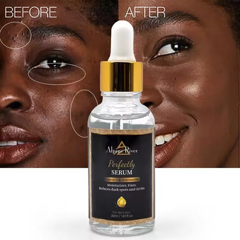 Alpine River OEM Herbal Freckle Lightening Skin Care Korean Vitamin C Dark Spot Removal Corrector Serum for Face Treatment