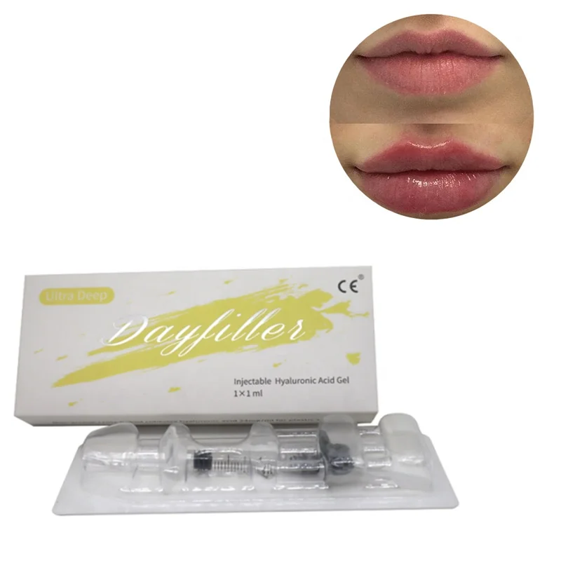 lip hyaluronic acid gel injections for buttocks/hyaluronic acid dermal filler injection/hyaluronic acid injection