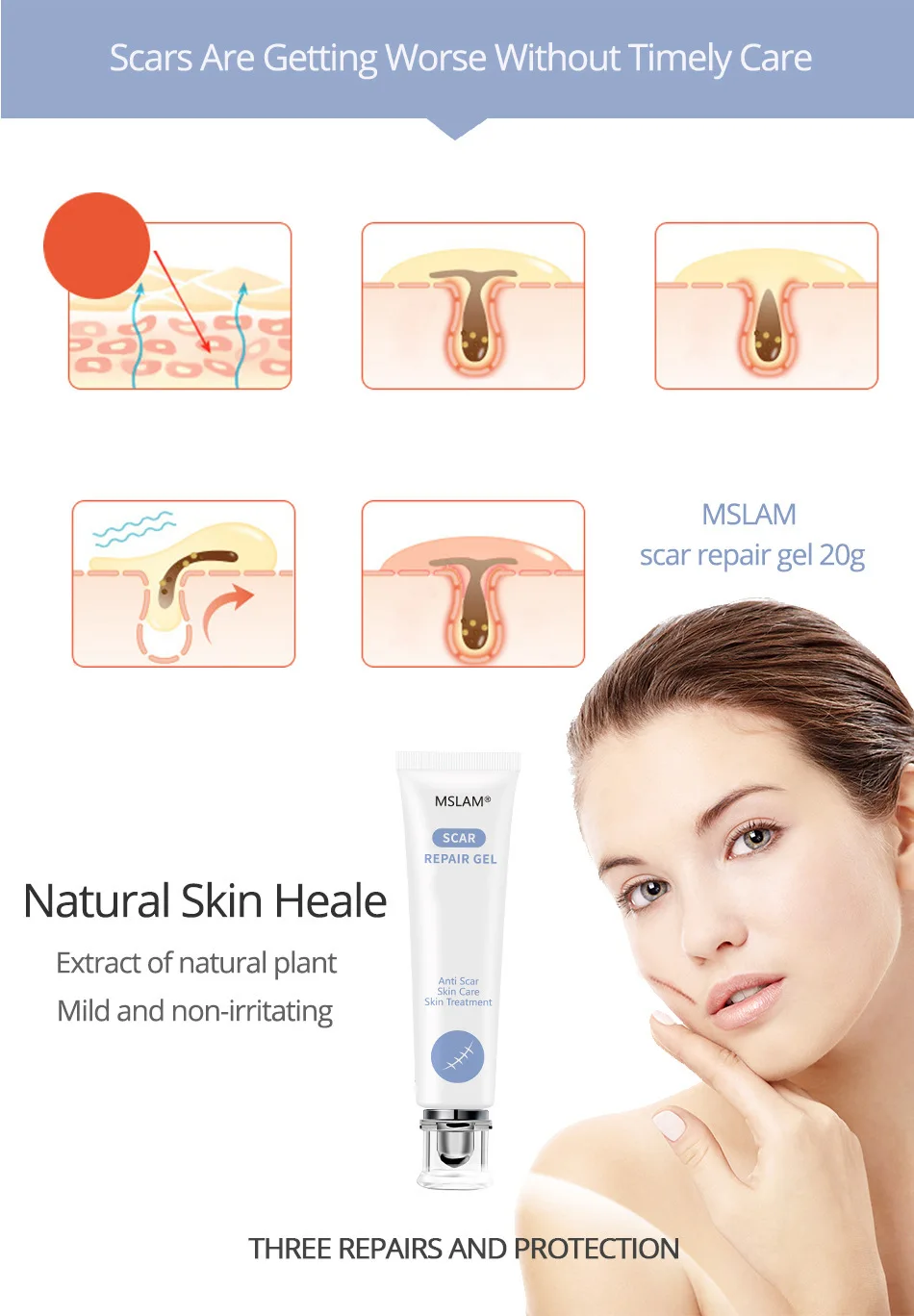 striae gravidarum cream