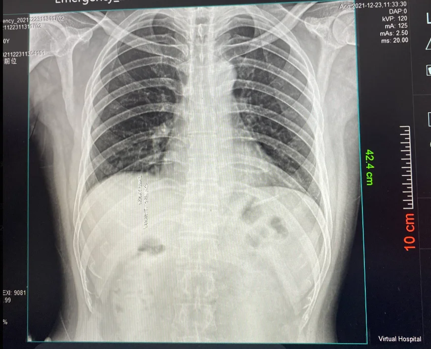 Medical Digital Portable X Ray Machine Handheld Fluoroscopic X-ray CarryX brand Touch LCD DR X Ray Unit