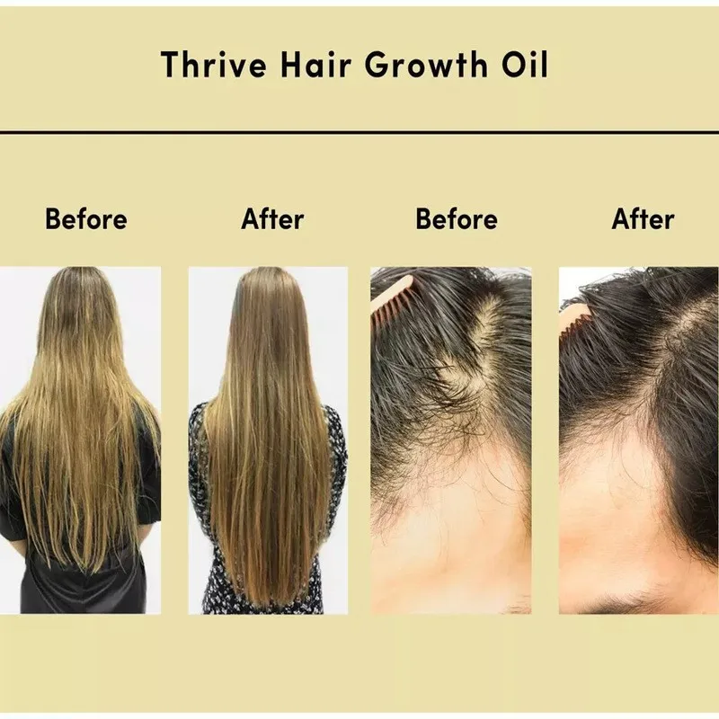 Professional Customization hair regrowth serum loss strengthen hair Powerful Oils Fast Thrive Hair Growth Power Mix Oil