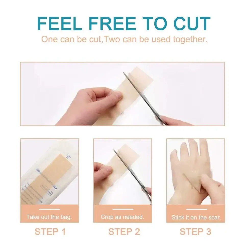 Silicone Scar Removal for Scars Caused by C-Section Surgery Burn Acne Works on Old & New Scars Reusable Sheets
