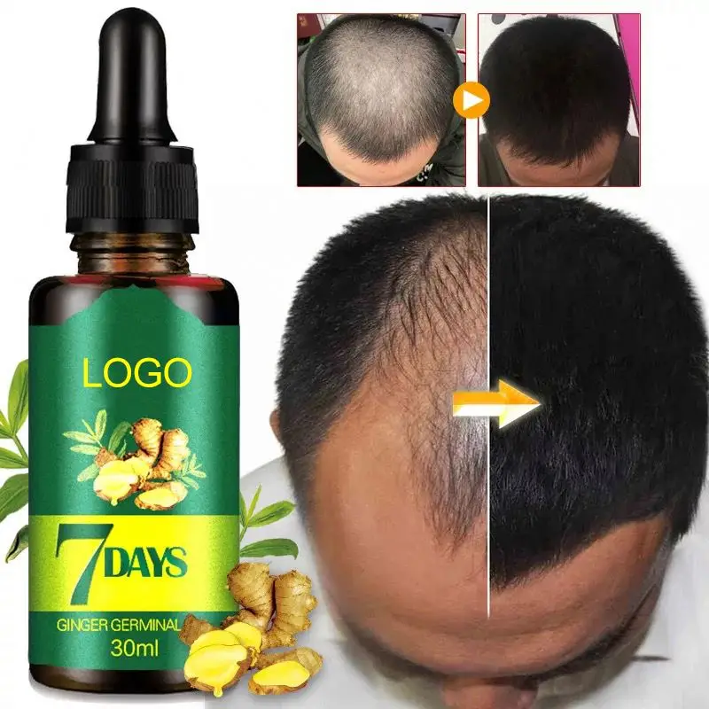 private label Wholesale 30ml Ginger Oil 7 Days Hair Growth Essential Oil For Hair Loss Treatment Regrowth Serum