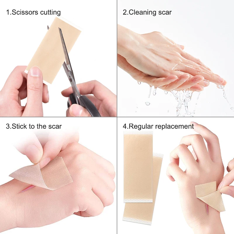 Hot Sell Silicon Scar Gel Silicone Scar Roll Silicone Scar Sheet