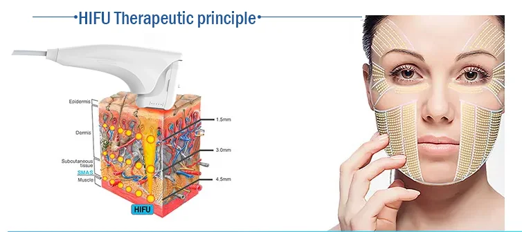 Hot sale anti wrinkle face lift  Six-in-one 4D Radar carving RF vaginal tightening machine Skin tightening beauty machine