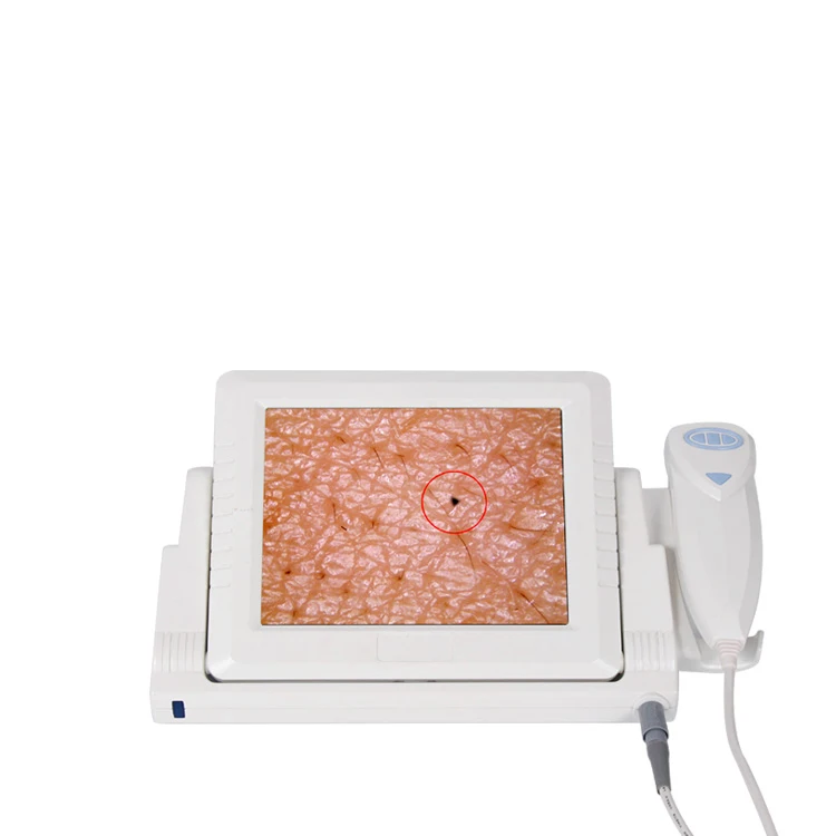 AYJ-J015(CE) 5mp iriscope iridology camera skin test and hair test machine with USB digital iriscope
