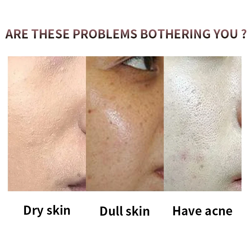 Korean Best Skincare Products Private Label Skincare Kit Manufacturer Moisturizing Mini Travel Size Rose Skincare Set For Face