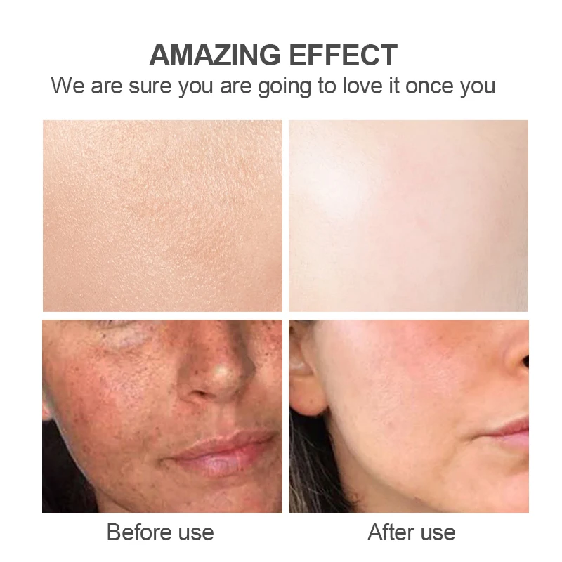 Private Label 6-Pcs Skin Care Set Includes Kojic Acid Whitening Lotion and Moisturizing Cream with Vitamin C Herbal Ingredients