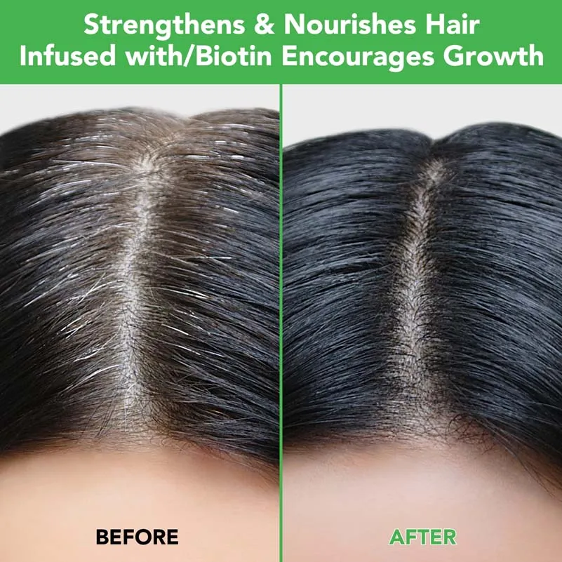 Conditioner Hair Growth Shampoo And Conditioner Private Label Hair Conditioner And Shampoo