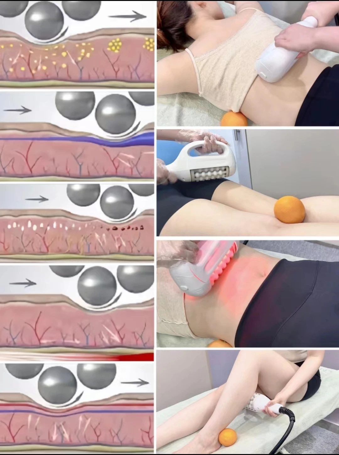 360 Degree BCM Cellusculptor  EN7   Massager Bodi Slim Roller Slimming  Inner Ball Roller Machine Bodi Cellulite Device