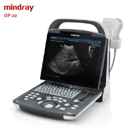 Mindray DP-20 портативный ультразвуковой цена УЗИ аппарат медицинское ультразвуковое оборудование для продажи