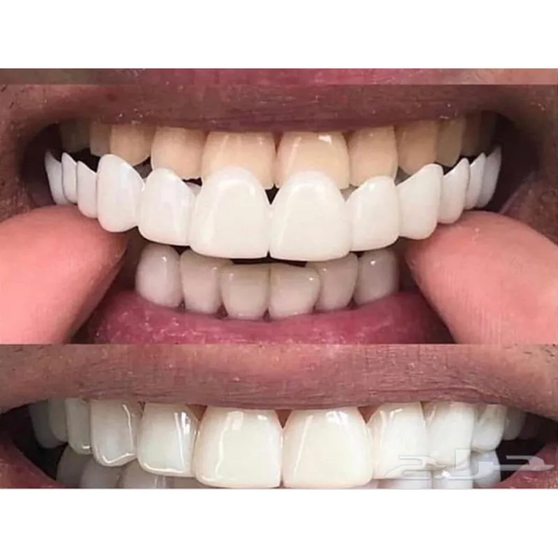 Customized label Vagen friendly Upper and Lower Resin False teeth cover Whitening Confortable kit Denture