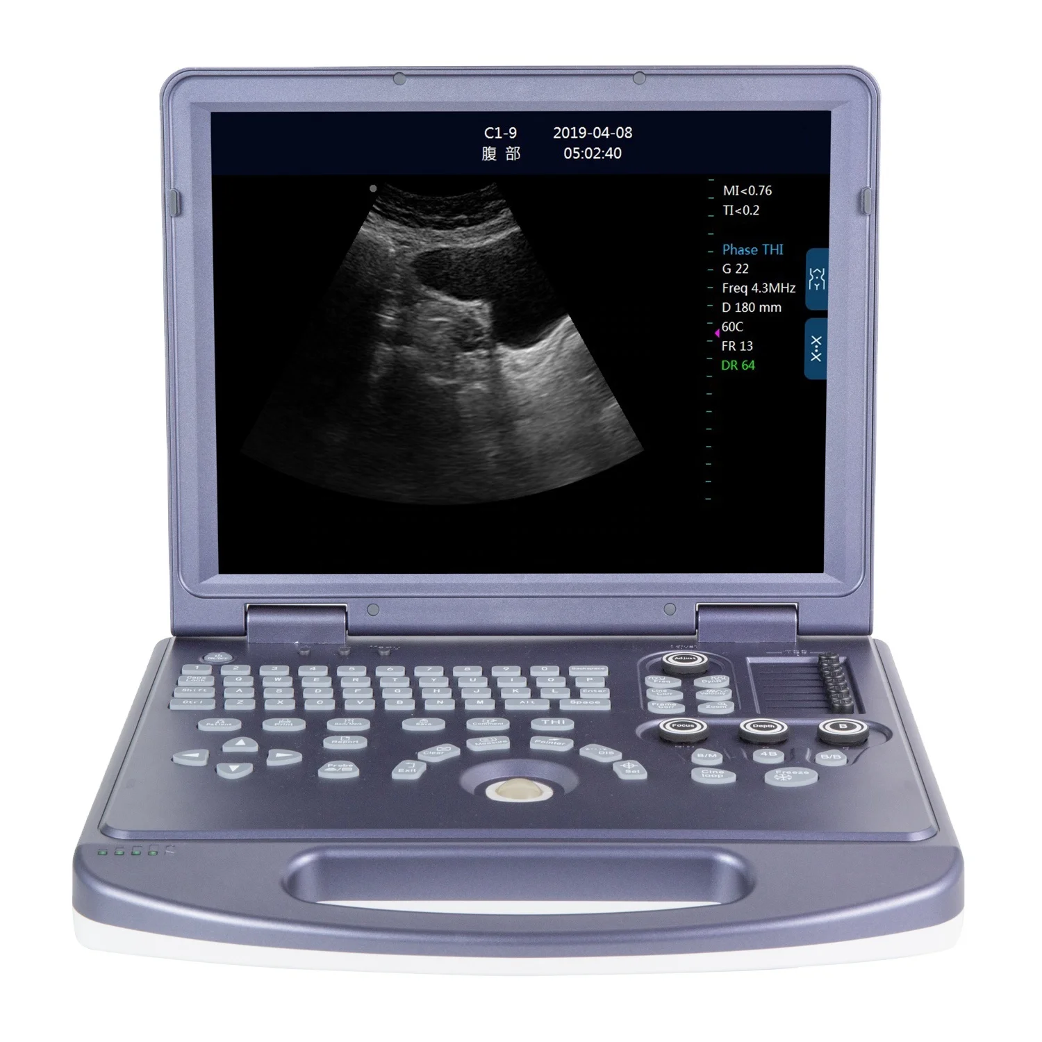 Portable Ultrasound Machine High-end PC Based Laptop BW Ultrasound Scanner Hospital Equipment Ultrasound Machine for Human