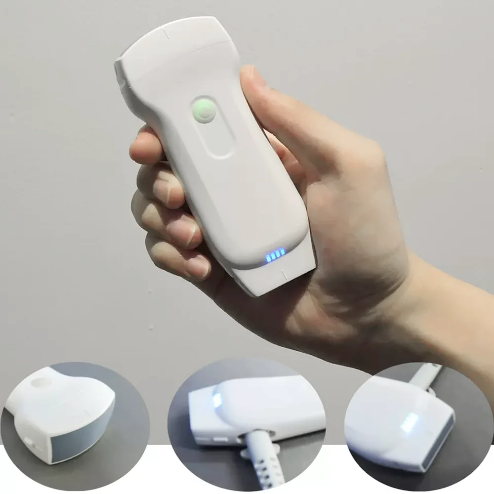 3 in 1 wireless ultrasound probe smartphone wifi linear Convex ultrasound probe ultrasound scan probe