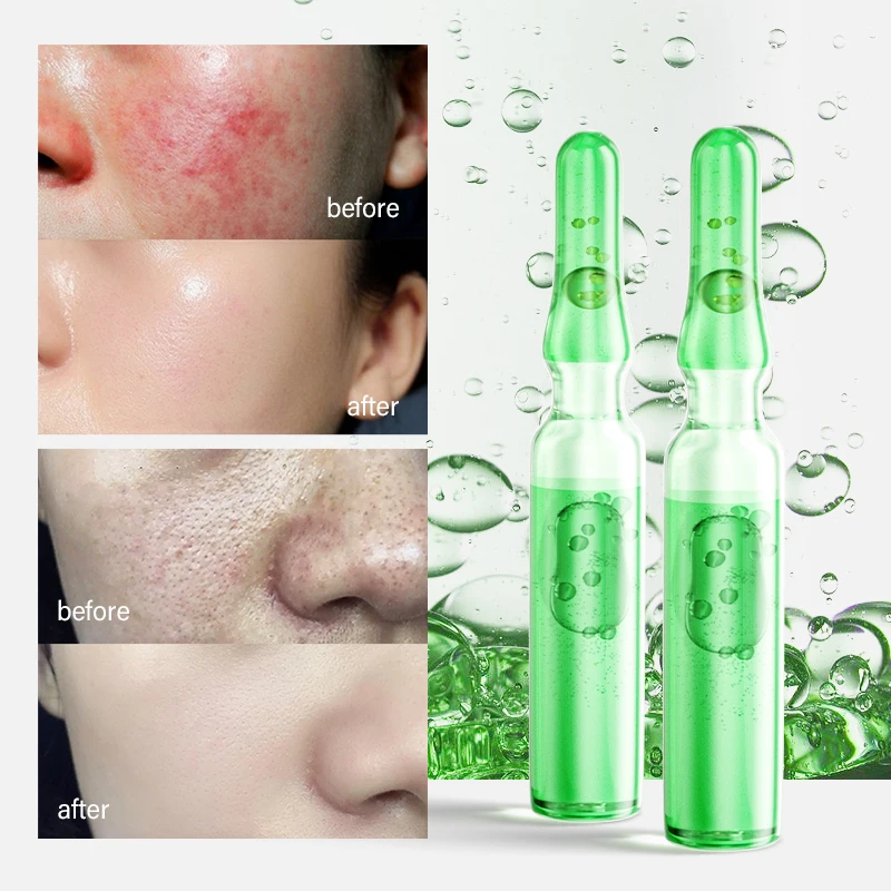 OEM Private Label Organic Vegan moisturizing acne pore improvement anti wrinkle aging acne whitening Ampoule serum of Purslane