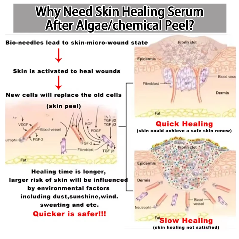 Epidermal Growth Factors Healing Power Human Korea Like For Post Algae Chemical Peel Microneedling Micro Needling Serum