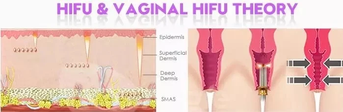 2025 Portable Vaginal Tightening Moisturizing Machine Anti aging, Firming, and Face slimming Machine