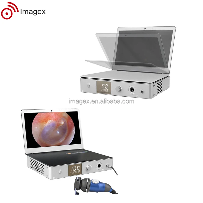 Tinyview 1000s all in one Medical Endoscopic Camera endoscopy System for Hospital Use