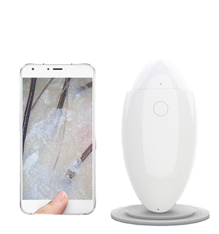 3.0MP mini scalp analyzer wireless connection to mobile phone tablet  camera video analysis comparison and storage