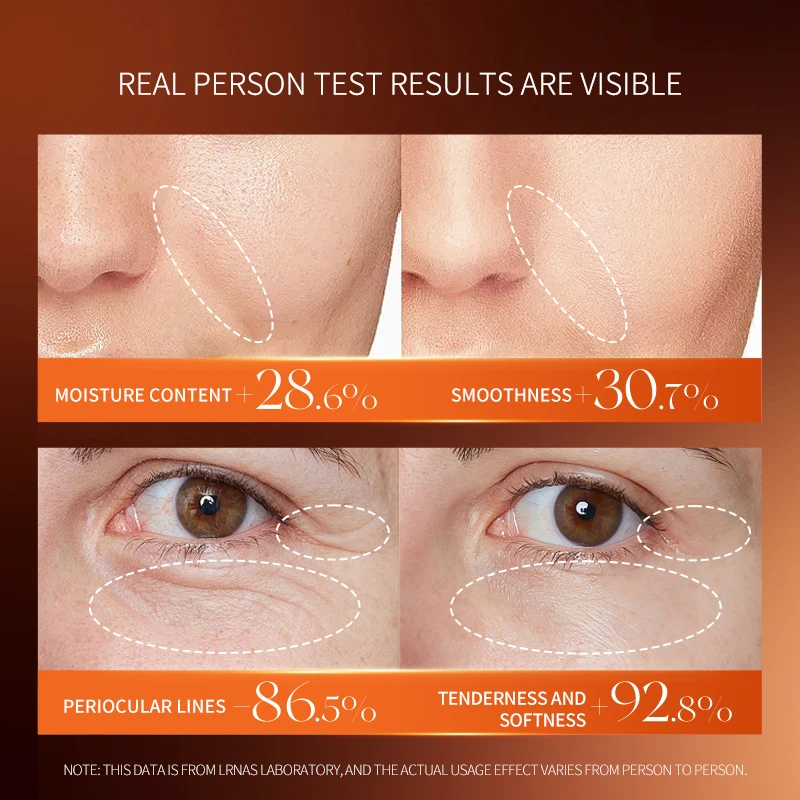 LRNAS Private Label Anti-Wrinkle Korea Skin Care Set Moisturizing Whitening Cream Women Luxury Beauty Face Care Products Sets