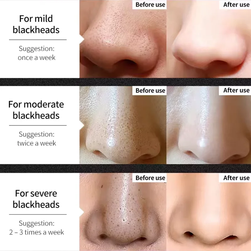 QUANXIN acne face mask deep cleansing peel off face mask nose charcoal blackhead remover mask