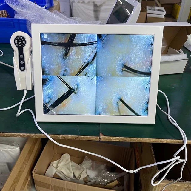 15 Inch HD Screen Portable Facial Skin Test Scanner Analyser Equipment Hair Skin Analyzer Machine For Sale