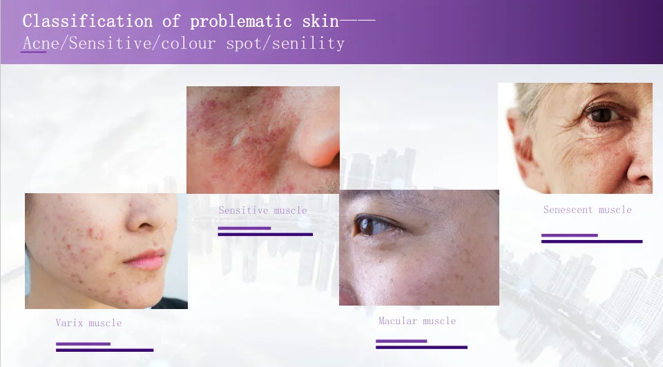 8 in1 Portable smart mirror scanner 3D facial skin analyzer machine digital skin beauty analyzer tester with screen