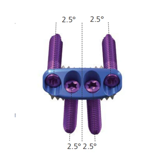 
Interbody Fusion Cage titanium trauma Anterior cervical plate high-quality implantes 