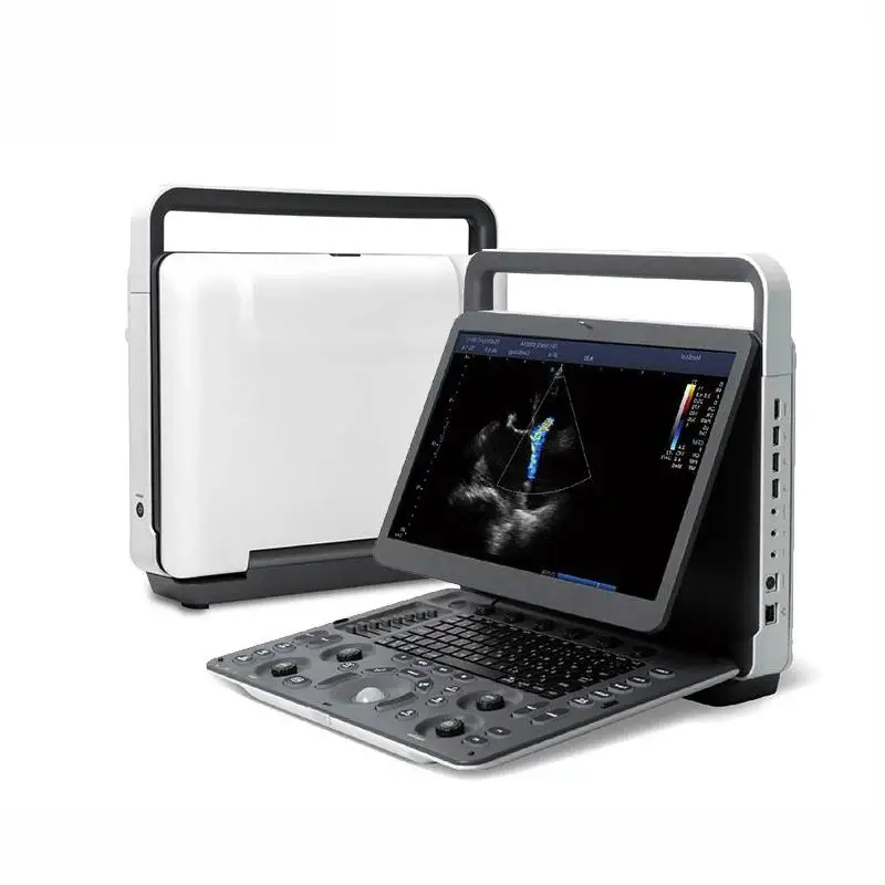 High Quality and Good price Sonoscape Brand E3V Diagnostic Color Doppler Ultrasound Scanner System for Hospital