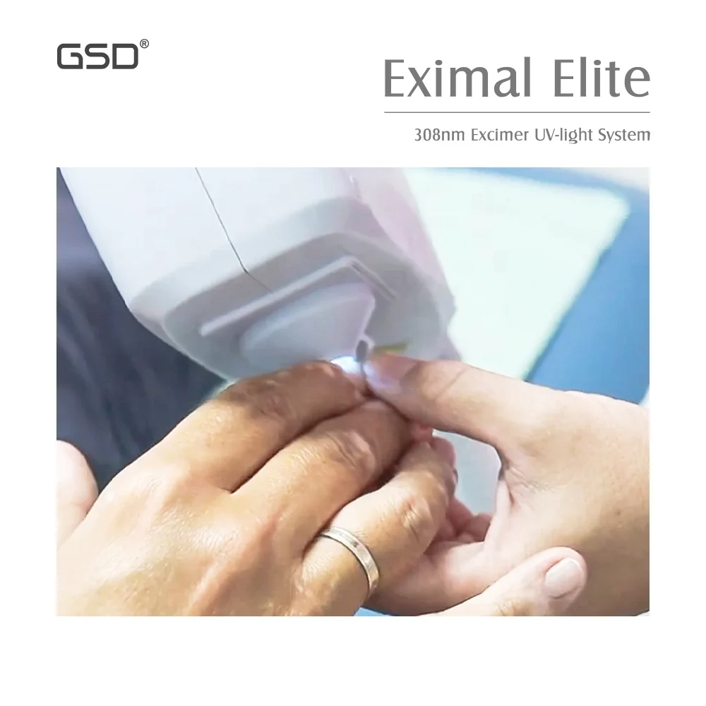 GSD 308nm Psoriasis Excimer Laser Uv Lamp Vitiligo