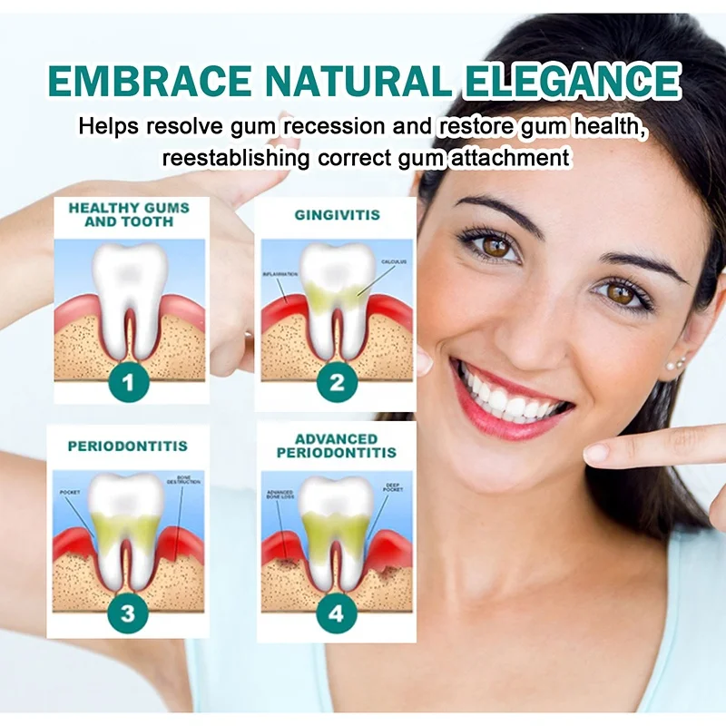 30ml gum care drops repair gum swelling clean tooth stains protect gum and whiten teeth oral health care essence