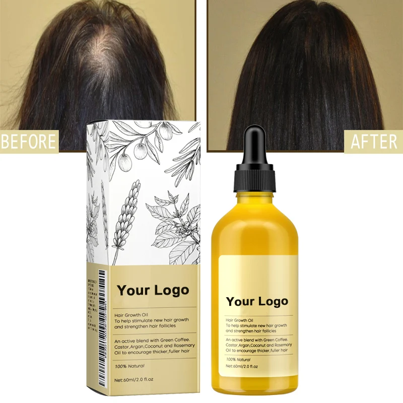 Private label Organic Hair Anti LossTreatment Fast Oil Growth Hair Serum Hair Growth Oil