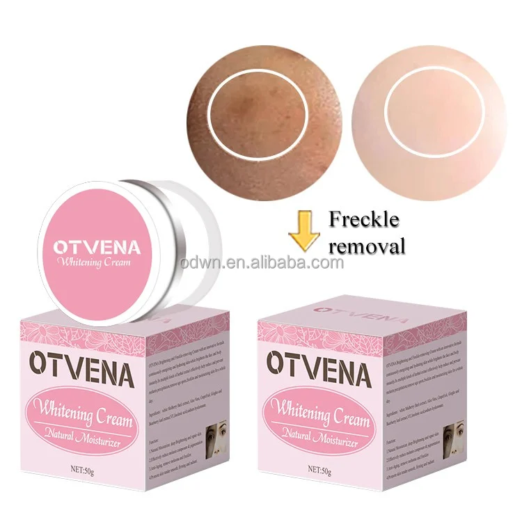 OTVENA wholesale organic cream melasma and freckles remover whitening cream for face