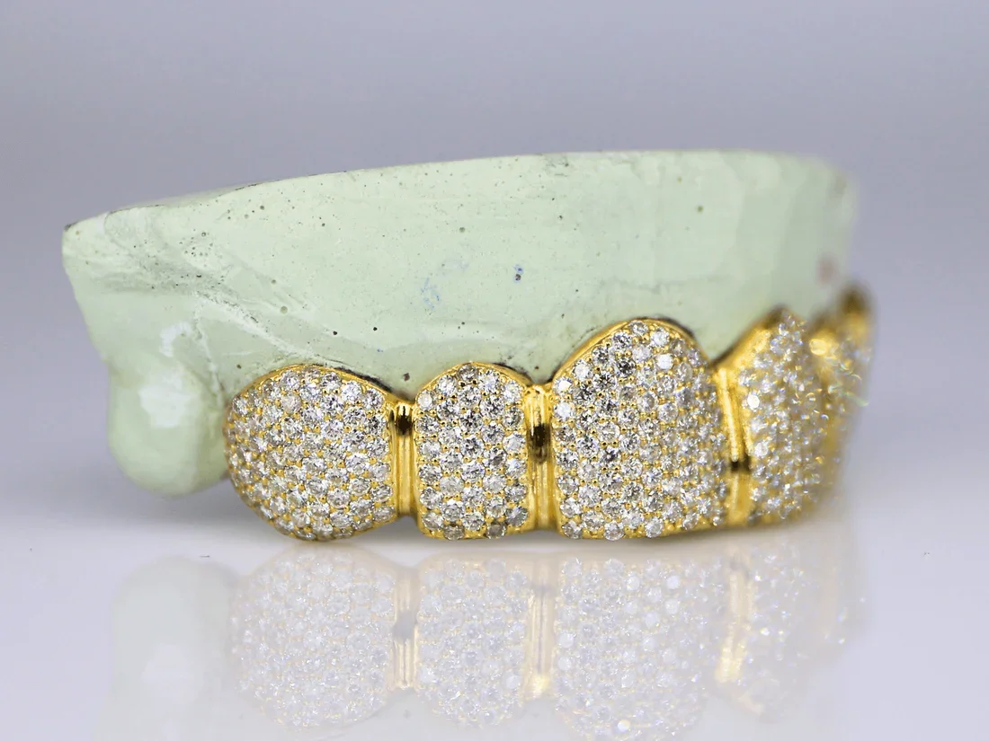 Hip Hop Jewelry Sterling Silver 925 Gold Plated 18K VVS Moissanite Custom Iecd Out Bling Teeth Grillz