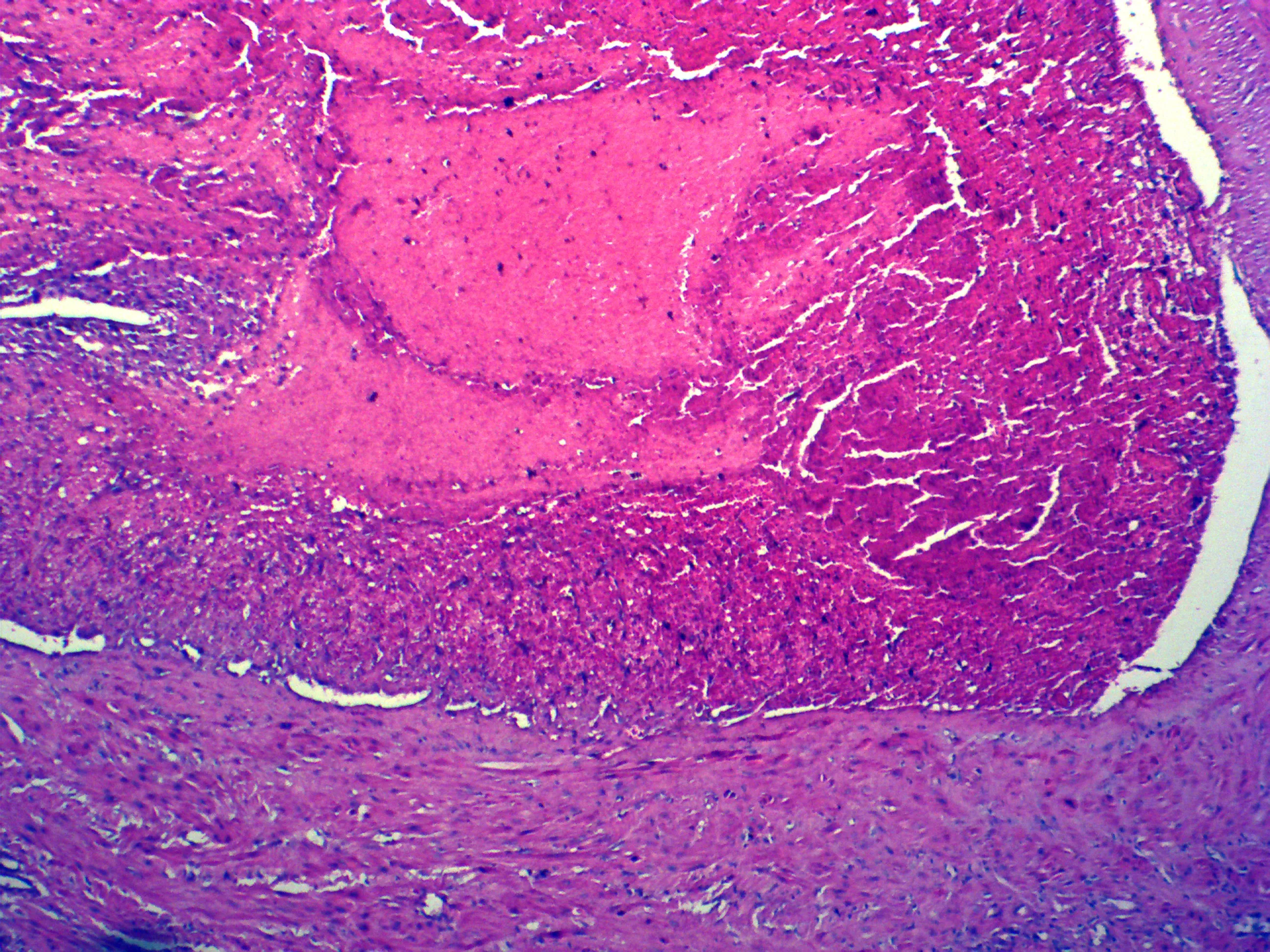 Medical biology laboratory human pathology preparation microscope slide specimen equipment